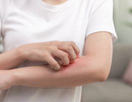 Transmission de la gale : causes, symptômes et solutions pour limiter les risques